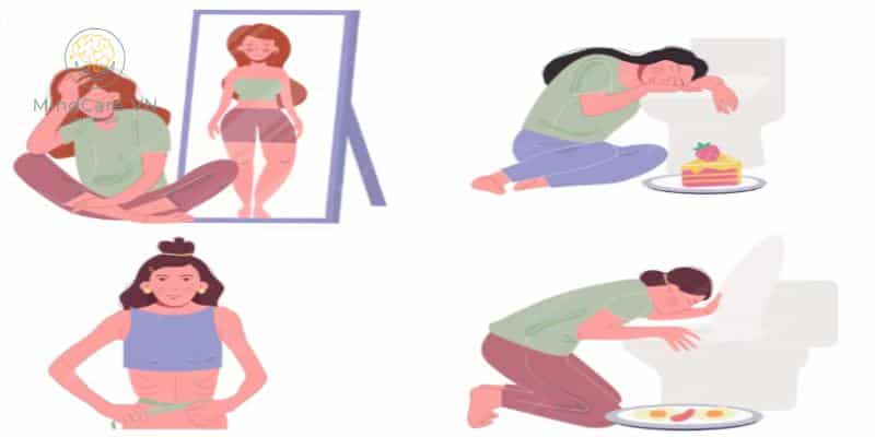 Rối loạn ăn uống (Eating Disorders) là nhóm bệnh lý tâm thần